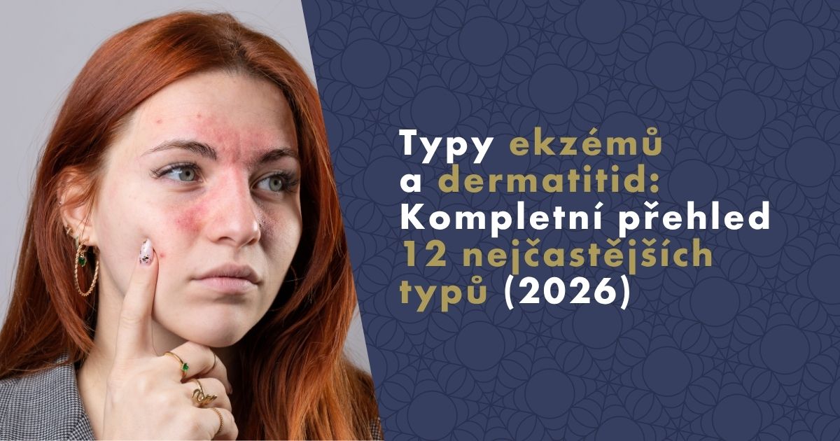 typy-ekzemu-a-dermatitid (1)